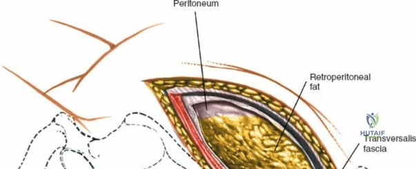 Clinical Image