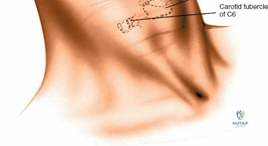 Clinical Image