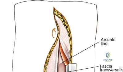 Clinical Image