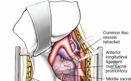 Clinical Image