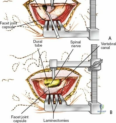 Clinical Image