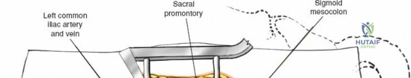 Clinical Image