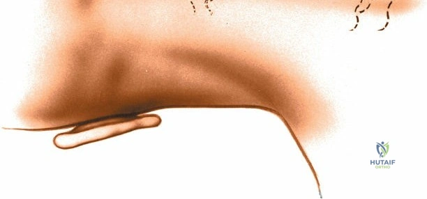 Clinical Image