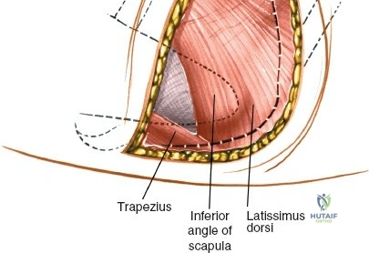 Clinical Image