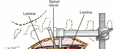 Clinical Image