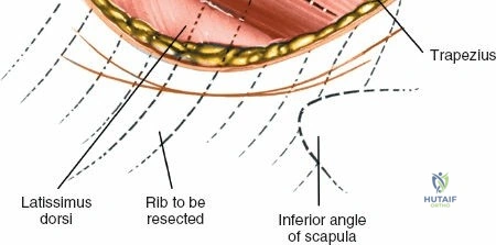 Clinical Image