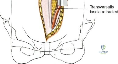 Clinical Image