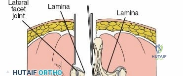 Clinical Image