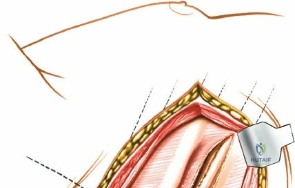 Clinical Image