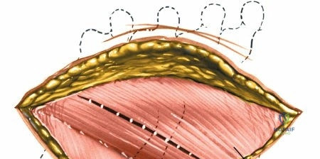 Clinical Image