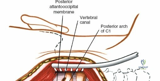 Clinical Image