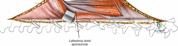 Clinical Image