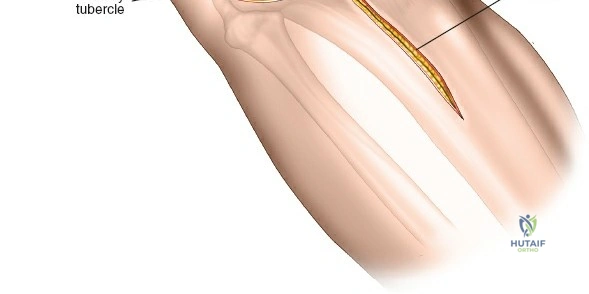 Clinical Image