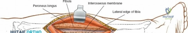 Clinical Image