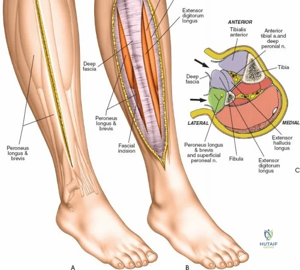 Clinical Image