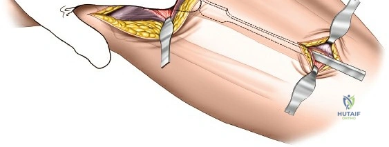 Clinical Image