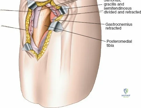Clinical Image