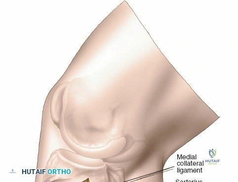 Clinical Image