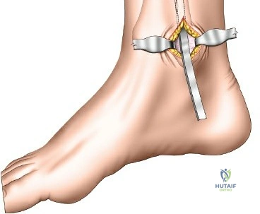 Clinical Image