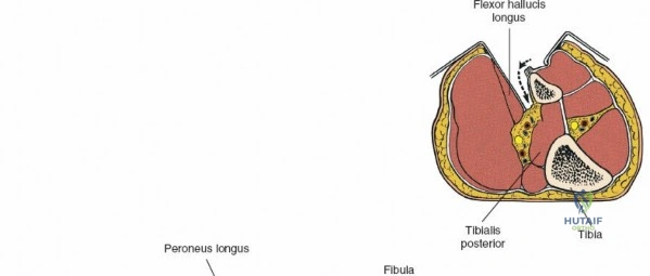 Clinical Image