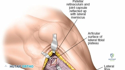 Clinical Image