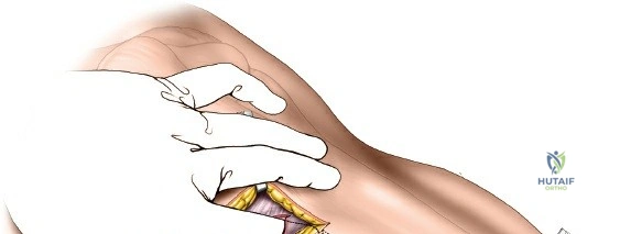 Clinical Image