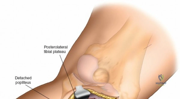 Clinical Image