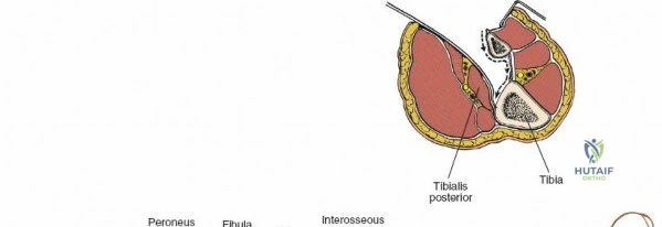 Clinical Image