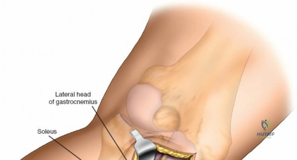 Clinical Image