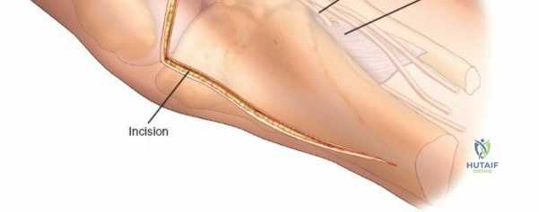 Clinical Image