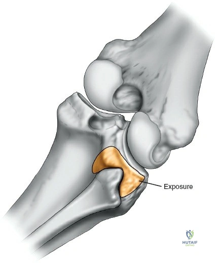 Clinical Image