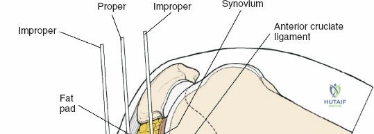 Clinical Image