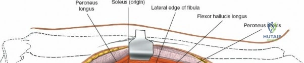 Clinical Image