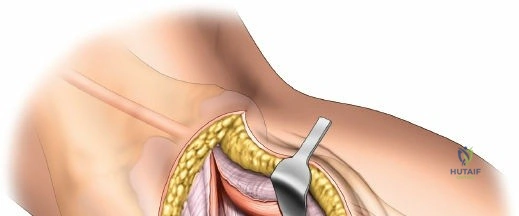 Clinical Image