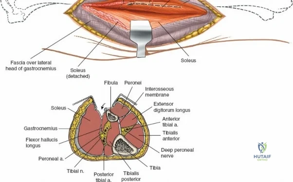 Clinical Image