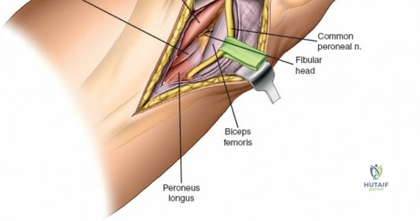 Clinical Image