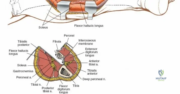 Clinical Image