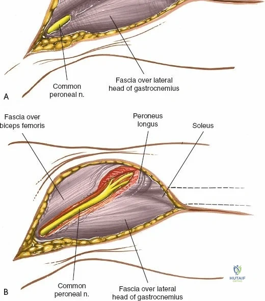 Clinical Image