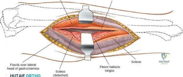 Clinical Image