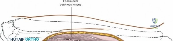 Clinical Image