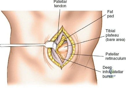 Clinical Image