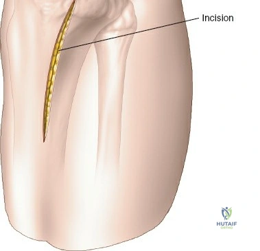 Clinical Image