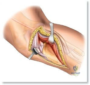 Clinical Image