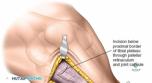 Clinical Image