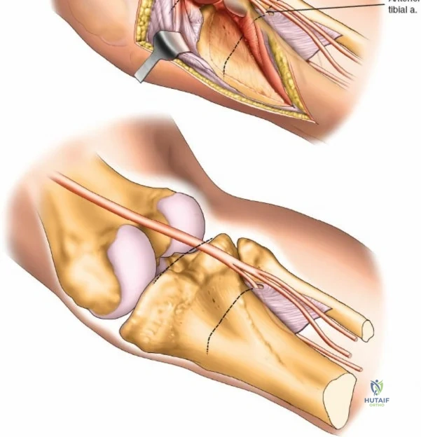 Clinical Image