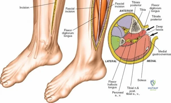 Clinical Image