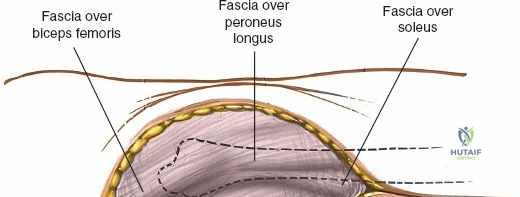 Clinical Image