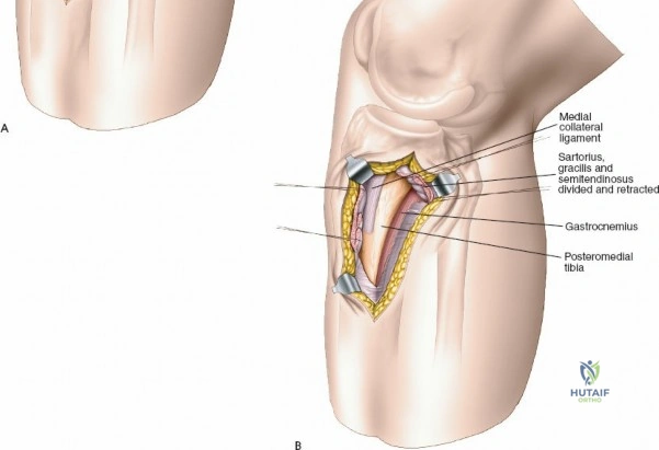 Clinical Image