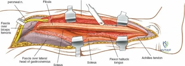 Clinical Image