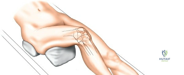 Clinical Image